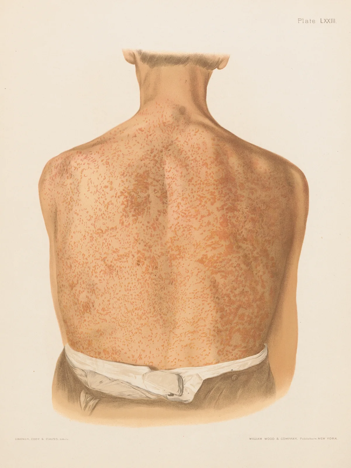 Chromophytosis av Prince Albert Morrow