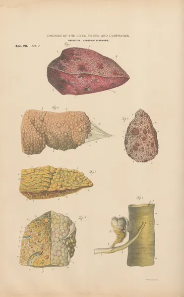 Hyperæmia and inflammation of the liver av Jean Allard Jeancon