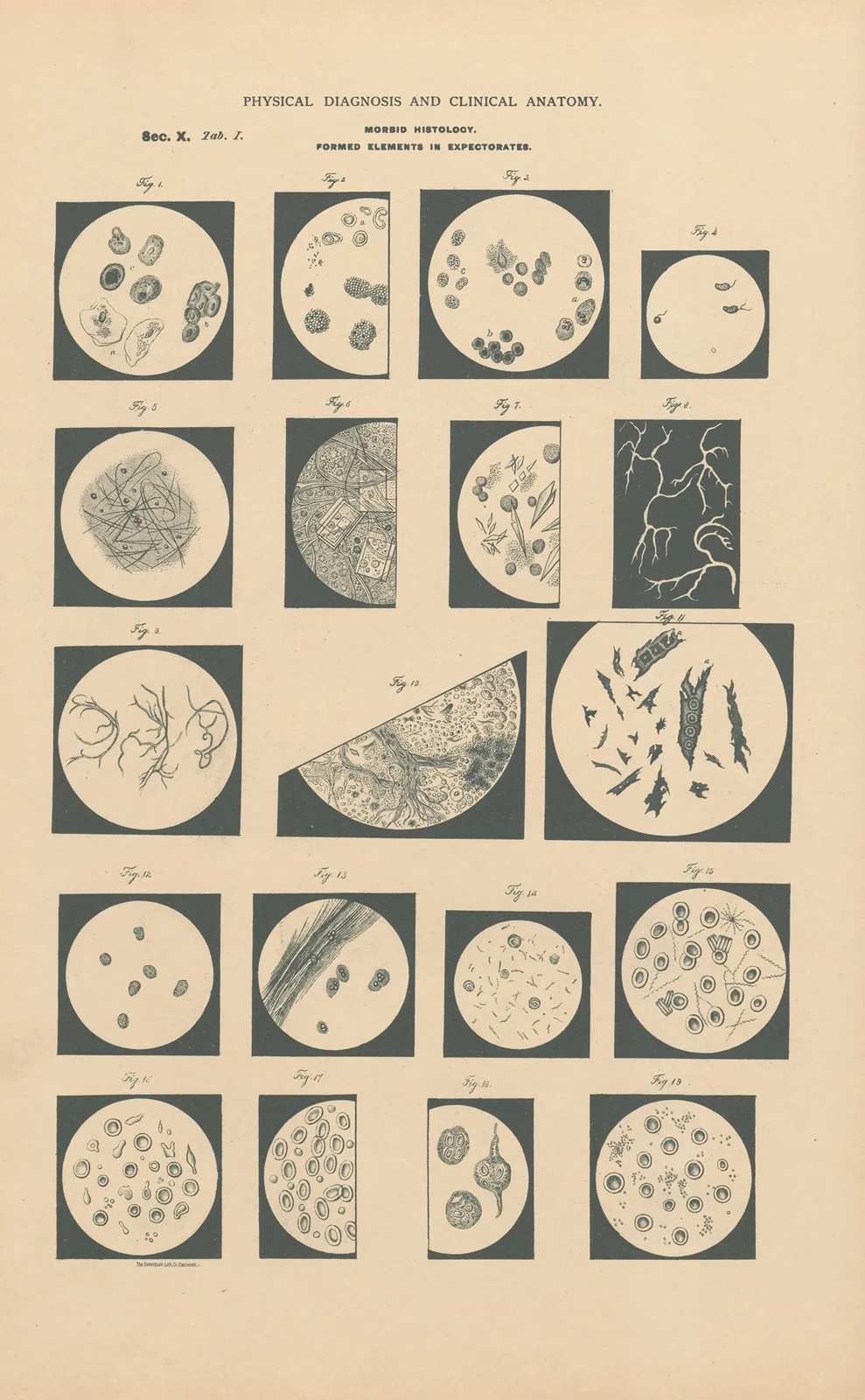 Morphological components in Expectorates av Jean Allard Jeancon