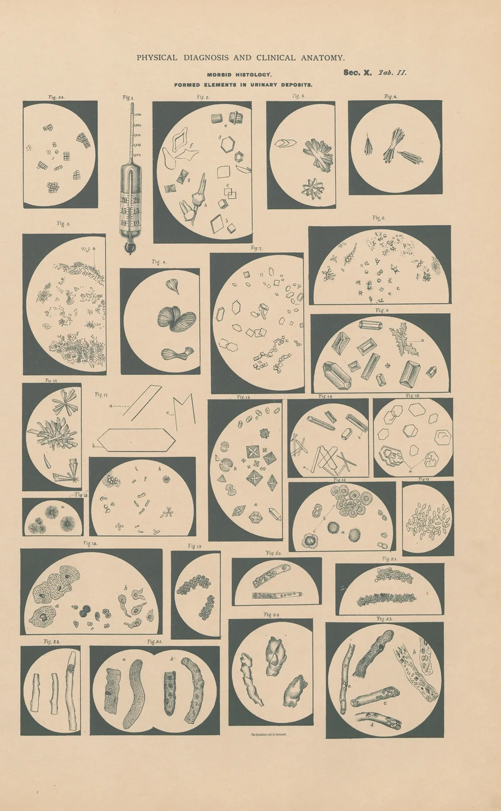 Morphological elements in urinary deposits av Jean Allard Jeancon