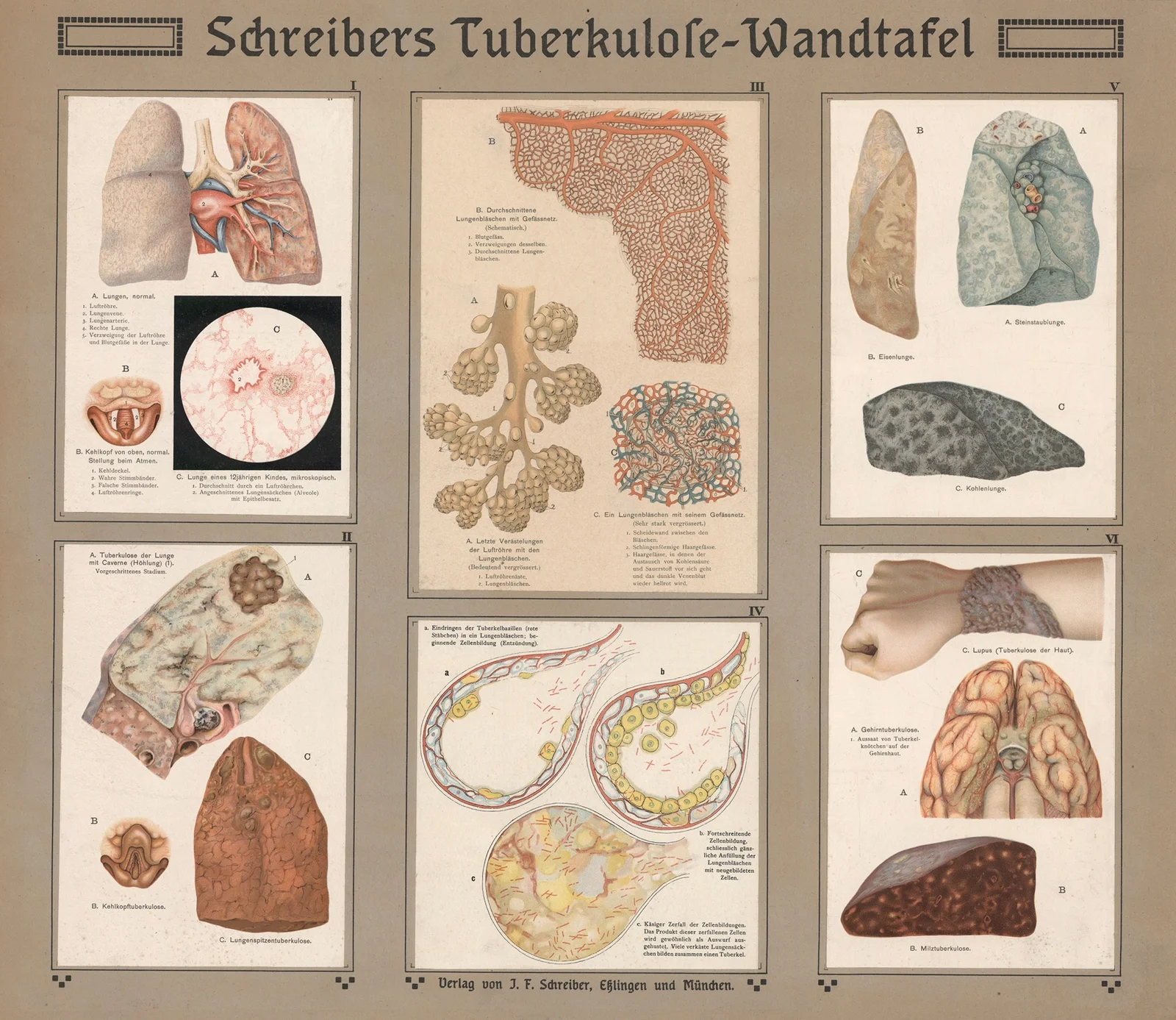 Schreiber’s tuberculosis table av J.F. Schreiber
