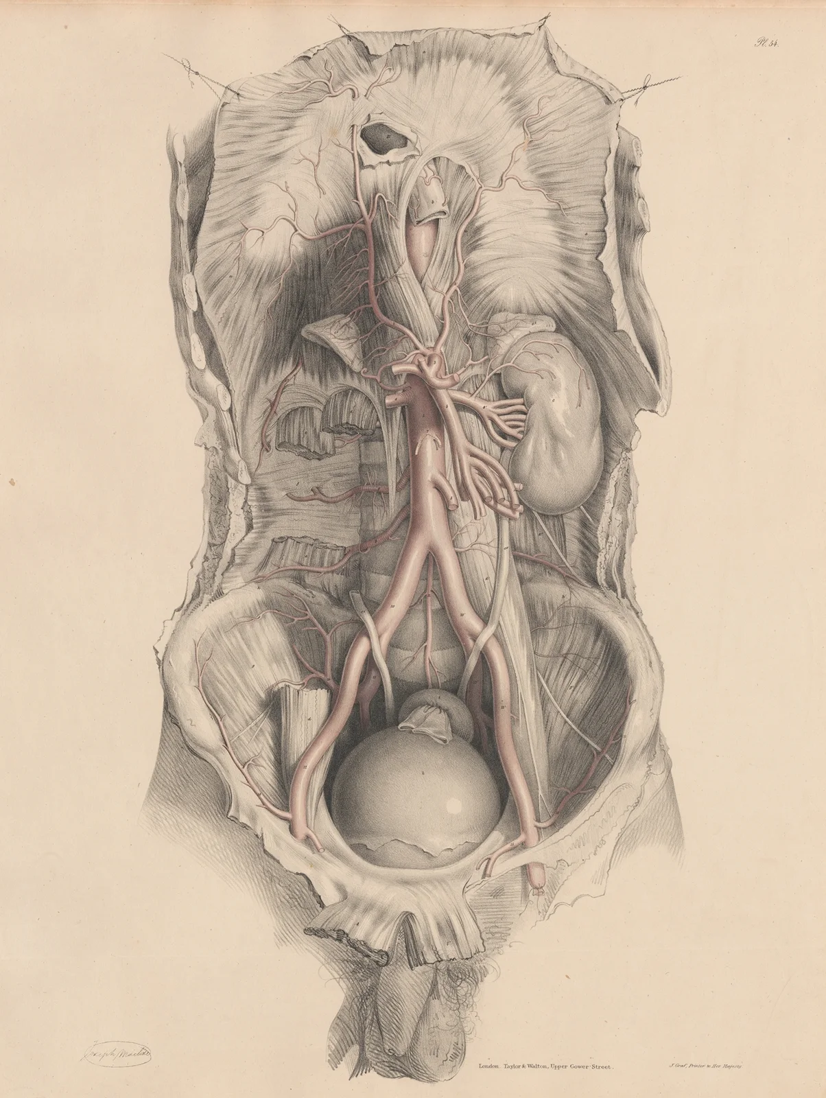The Abdominal Aorta av Joseph Maclise