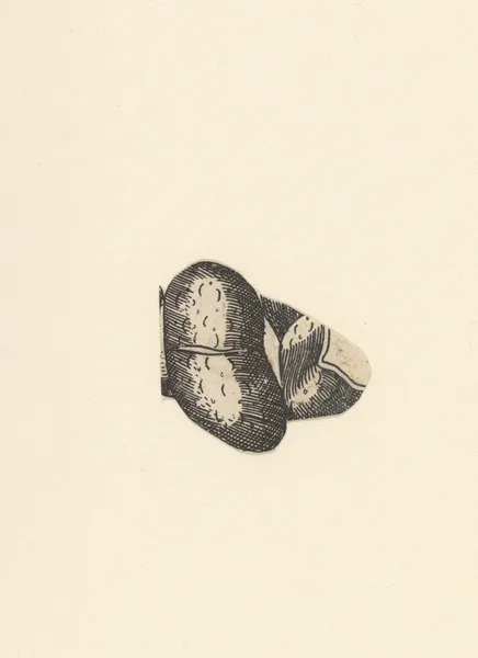 Kidney. – nr 2 av Lucas Kilian